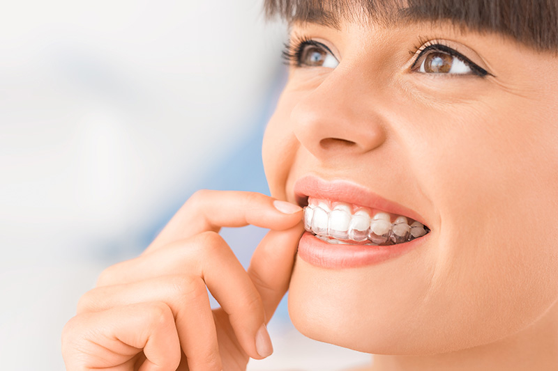 Ramin Assili DDS Invisalign in Northridge
