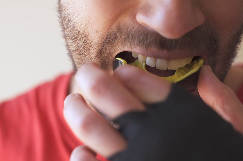 Sports Mouth Guards in Northridge