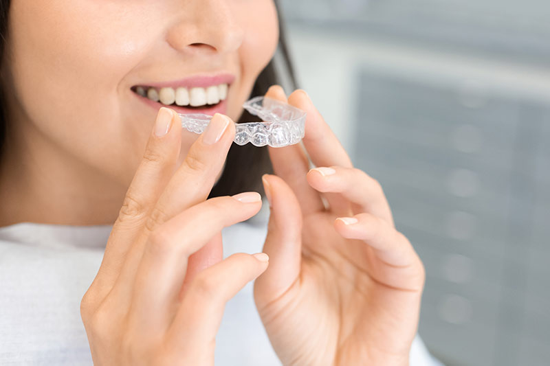 Special Dental Offer Northridge
